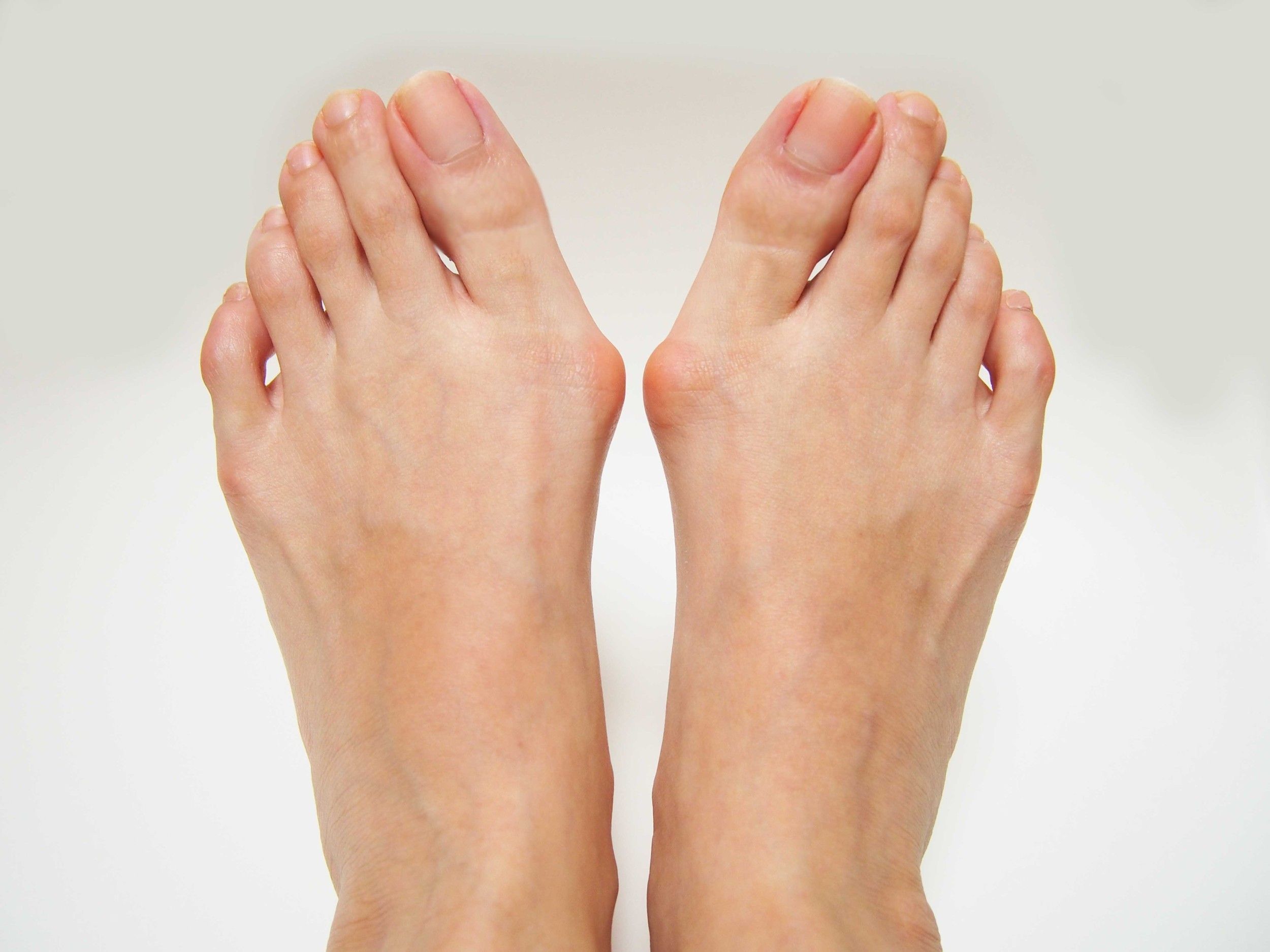 Deformities