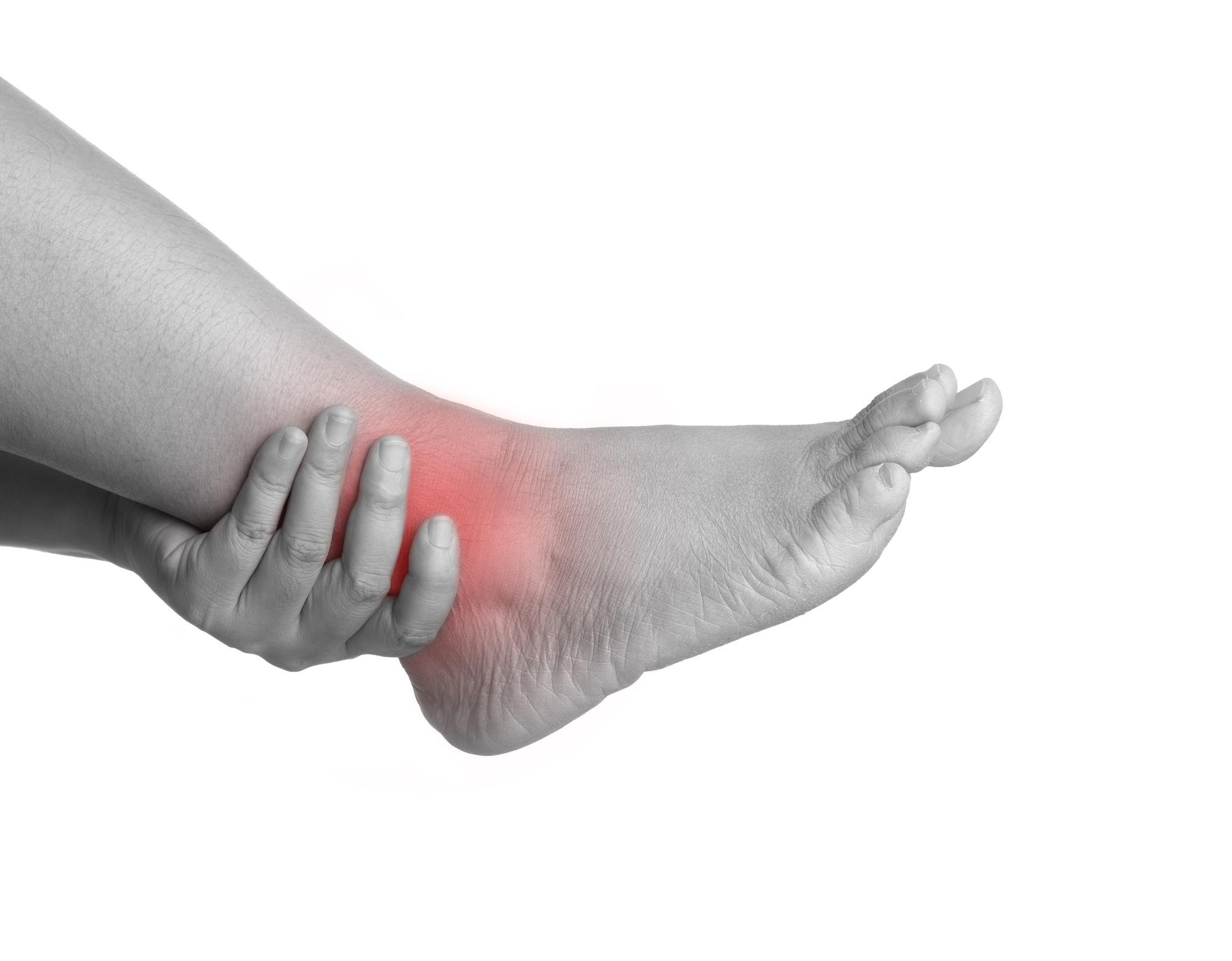 Arthritis