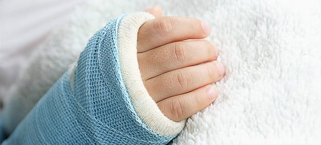 Child with arm splint